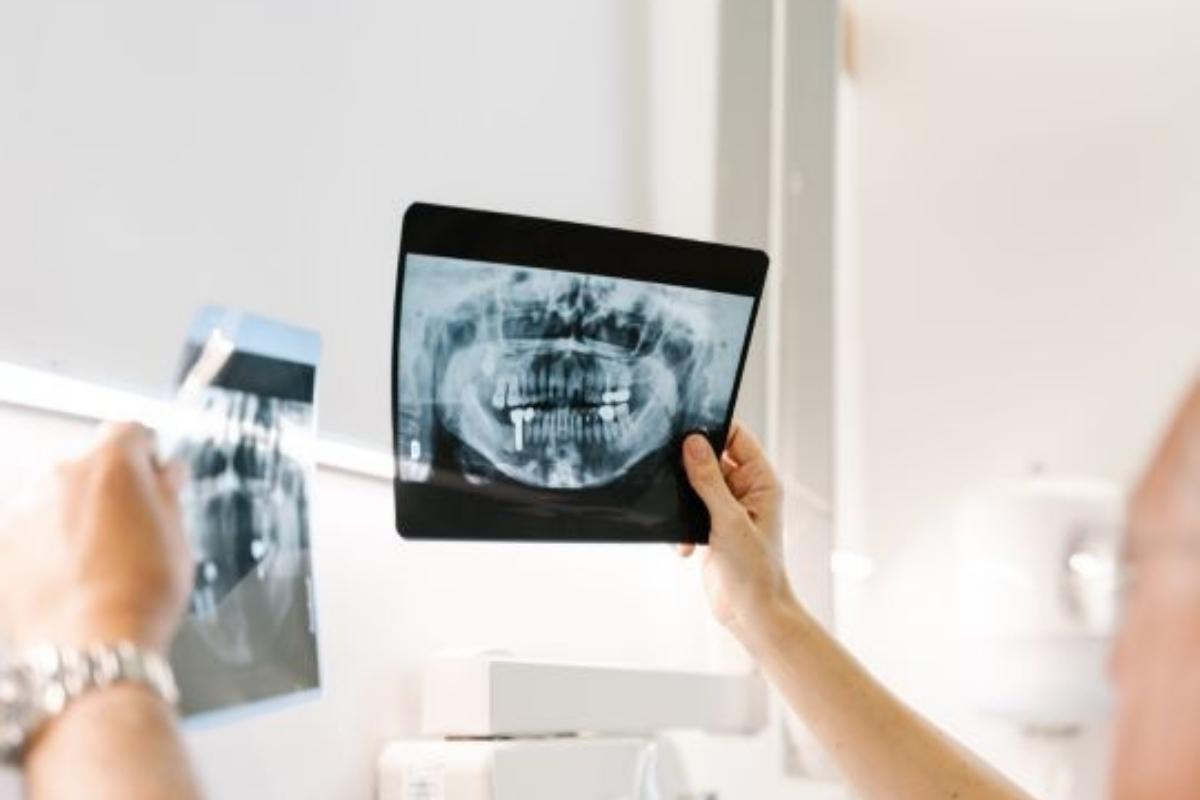 Dental Radiographs for Pets: Why They Matter for Oral Health